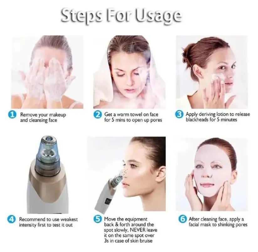 Deep Pore Cleaner Vacuum Blackhead Remover | Facial Pore Cleanser | Acne & Whitehead Removal Device