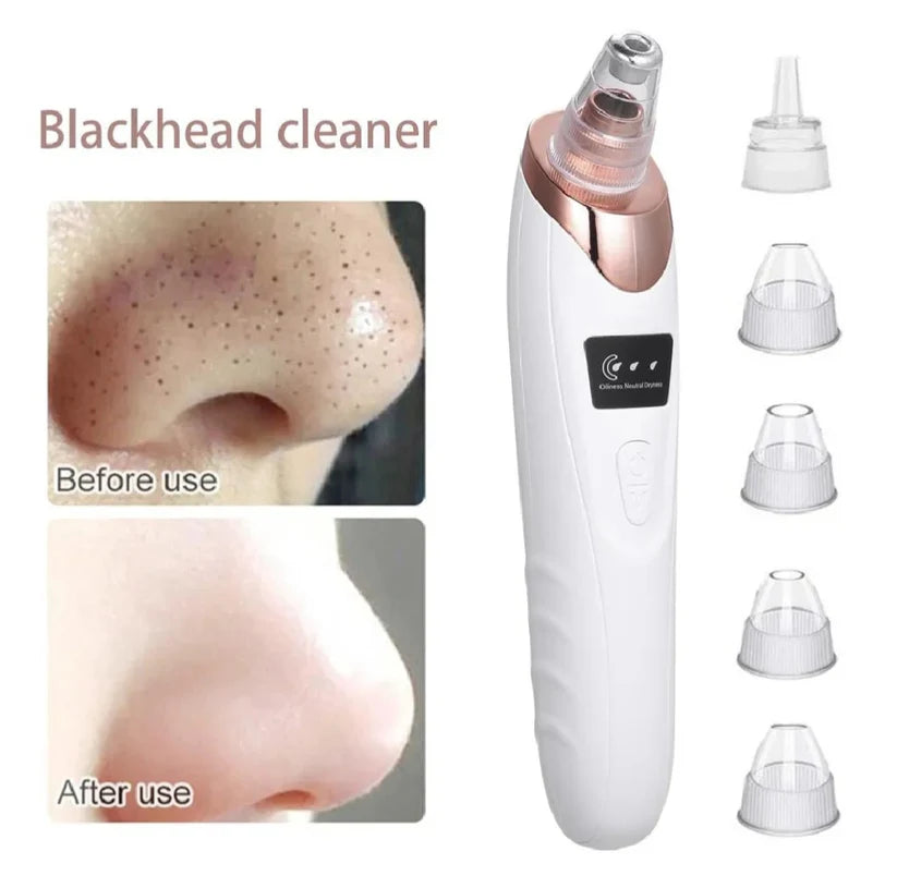 Deep Pore Cleaner Vacuum Blackhead Remover | Facial Pore Cleanser | Acne & Whitehead Removal Device