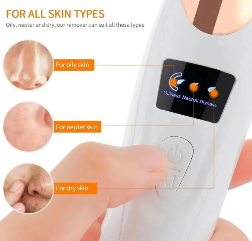 Deep Pore Cleaner Vacuum Blackhead Remover | Facial Pore Cleanser | Acne & Whitehead Removal Device