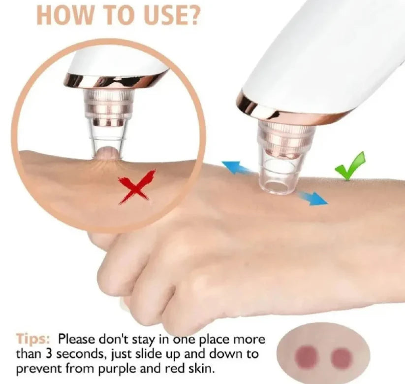 Deep Pore Cleaner Vacuum Blackhead Remover | Facial Pore Cleanser | Acne & Whitehead Removal Device