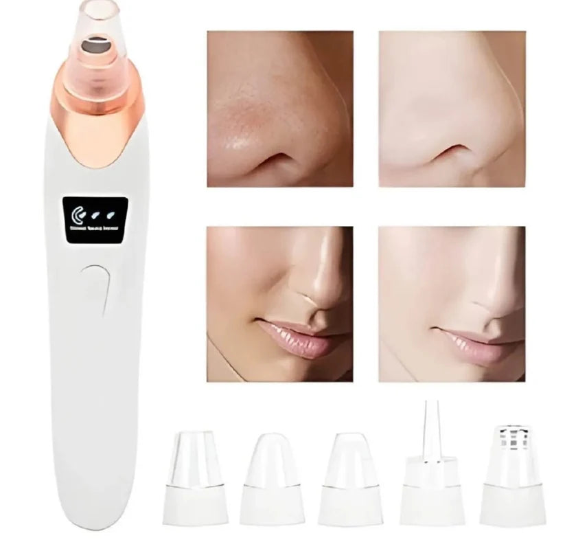 Deep Pore Cleaner Vacuum Blackhead Remover | Facial Pore Cleanser | Acne & Whitehead Removal Device